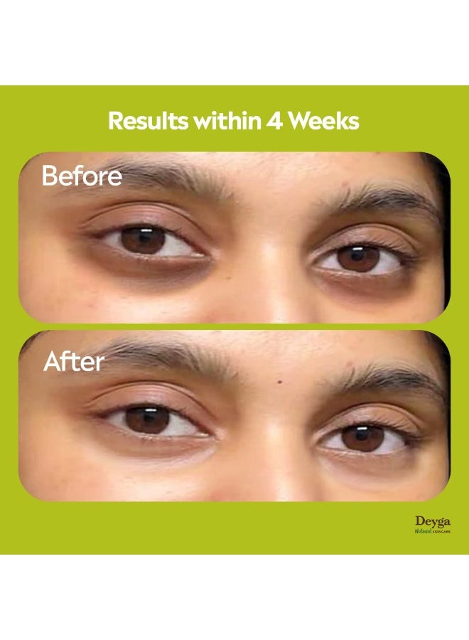 Deyga Under Eye Cream 15g | Lightens Dark Circles, Reduces Puffiness & Fine Lines | Chemical-Free | For Men & Women - Image 4
